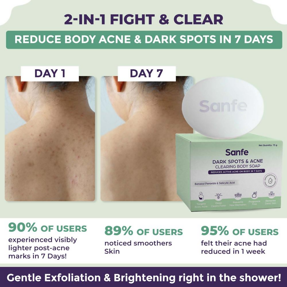 Sanfe Dark Spots & Acne Clearing Body Soap